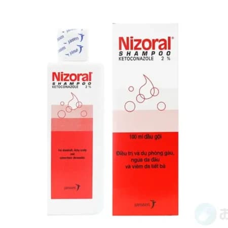 ニゾラールシャンプー(ニズラルシャンプー)脂漏性皮膚炎の治療｜2,980円〜 2