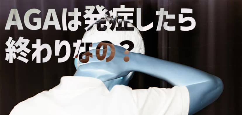 「AGAは発症したら終わり」は本当？進行を防ぐ対策と治療法を解説